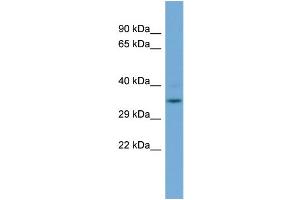 WB Suggested Anti-GLOD4  Antibody Titration: 0. (GLOD4 抗体  (N-Term))