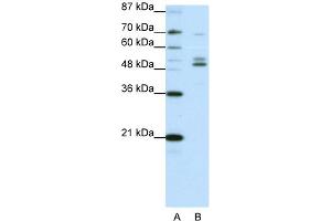 WB Suggested Anti-FOXA2 Antibody Titration:  0. (FOXA2 抗体  (C-Term))