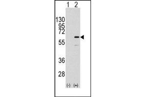 Image no. 1 for anti-ELK1, Member of ETS Oncogene Family (ELK1) (Ser383) antibody (ABIN358791) (ELK1 抗体  (Ser383))