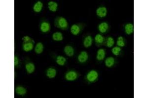 Immunocytochemistry staining of HeLa cells fixed with 4 % Paraformaldehyde and using anti-SMC1A mouse mAb(dilution 1:100). (SMC1A 抗体  (C-Term))