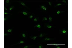 Immunofluorescence of monoclonal antibody to PLRG1 on HeLa cell.