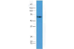 Lane 1: mouse embryo lysates probed with Rabbit Anti-GAD65 + GAD67 Polyclonal Antibody, Unconjugated (ABIN1714177) at 1:300 overnight at 4 °C. (GAD65+GAD67 (AA 351-450) 抗体)