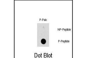 Dot blot analysis of Phospho-HSBP1-S78 polyclonal antibody (ABIN389744 and ABIN2839677) on nitrocellulose membrane. (HSP27 抗体  (pSer78))