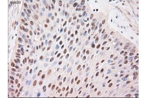 Immunohistochemical staining of paraffin-embedded kidney using anti-Stat4 (ABIN2452527) mouse monoclonal antibody. (STAT4 抗体  (AA 633-652))