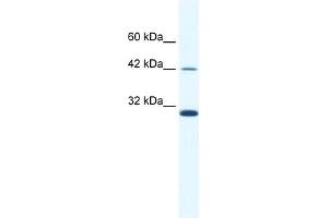 WB Suggested Anti-APOBEC3G Antibody   Titration: 2. (APOBEC3G 抗体  (N-Term))
