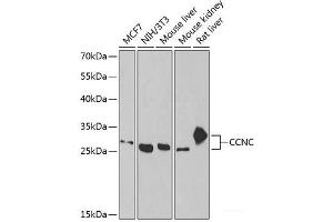 Western blot analysis of extracts of various cell lines using CCNC Polyclonal Antibody at dilution of 1:1000. (Cyclin C 抗体)