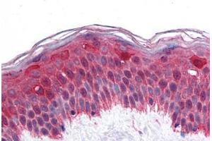 Human Skin: Formalin-Fixed, Paraffin-Embedded (FFPE) (LHX8 抗体  (AA 1-321))