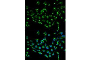 Immunofluorescence analysis of MCF-7 cells using CDKN3 antibody (ABIN5971092). (CDKN3 抗体)
