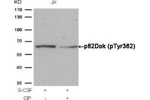 Western blot analysis of extracts from JK cells, treated with G-CSF or calf intestinal phosphatase (CIP), using p62Dok (phospho-Tyr362) Antibody. (DOK1 抗体  (pTyr362))