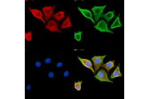 ABIN7095352 and ABIN7099409 staining HepG2 cells by IF/ICC. (SCARA5 抗体)