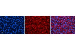 FMO5 antibody - middle region          Formalin Fixed Paraffin Embedded Tissue:  Human Liver Tissue    Observed Staining:  Cytoplasm in hepatocytes   Primary Antibody Concentration:  1:600    Secondary Antibody:  Donkey anti-Rabbit-Cy3    Secondary Antibody Concentration:  1:200    Magnification:  20X    Exposure Time:  0. (FMO5 抗体  (Middle Region))