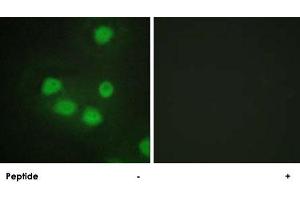 Immunofluorescence analysis of HepG2 cells, using SIX6 polyclonal antibody . (SIX Homeobox 6 抗体)