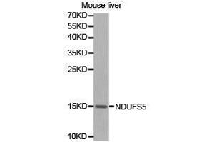 Western Blotting (WB) image for anti-NADH Dehydrogenase (Ubiquinone) Fe-S Protein 5, 15kDa (NADH-Coenzyme Q Reductase) (NDUFS5) antibody (ABIN1873864) (NDUFS5 抗体)