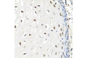 Immunohistochemistry of paraffin-embedded human esophagus using CNOT8 antibody at dilution of 1:100 (x40 lens). (CNOT8 抗体)
