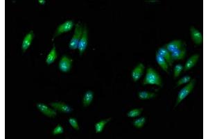 Immunofluorescence staining of Hela cells with ABIN7167480 at 1:266, counter-stained with DAPI. (RIPK3 抗体  (AA 1-518))