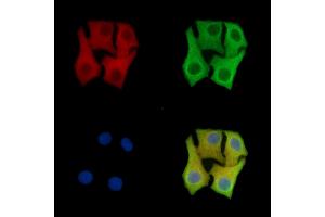 ABIN7096418 and ABIN7100482 staining Hela cells by IF/ICC. (SEPHS2 抗体)
