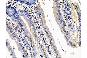 ABIN7095075 and ABIN7099131 at 1/100 staining rat colorectal tissue by IHC-P. (CRB3 抗体)