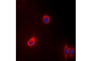 Immunofluorescent analysis of EEF2 staining in A431 cells. (EEF2 抗体  (N-Term))