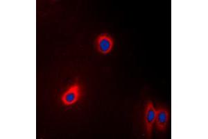 Immunofluorescent analysis of EEF2 staining in A431 cells. (EEF2 抗体  (N-Term))