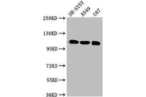 Western Blot Positive WB detected in: SH-SY5Y whole cell lysate, A549 whole cell lysate, U87 whole cell lysate All lanes: LRP8 antibody at 3 μg/mL Secondary Goat polyclonal to rabbit IgG at 1/50000 dilution Predicted band size: 106, 78, 100, 88 kDa Observed band size: 106 kDa (LRP8 抗体  (AA 131-332))