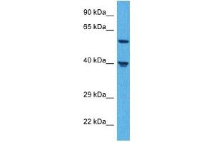 Western Blotting (WB) image for anti-Solute Carrier Family 39 (Metal Ion Transporter), Member 5 (SLC39A5) (N-Term) antibody (ABIN2781736)