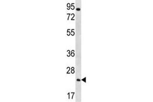 AQP5 antibody western blot analysis in NCI-H292 lysate (Aquaporin 5 抗体  (AA 227-256))