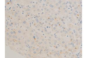 ABIN6267270 at 1/100 staining human liver tissue sections by IHC-P. (c-FOS 抗体  (pSer362))