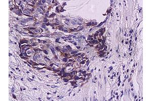 Immunohistochemistry (IHC) image for anti-Zinc Finger, Matrin-Type 3 (ZMAT3) (AA 201-288) antibody (ABIN730108)