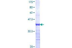 TRIM33 Protein (AA 1006-1105) (GST tag)