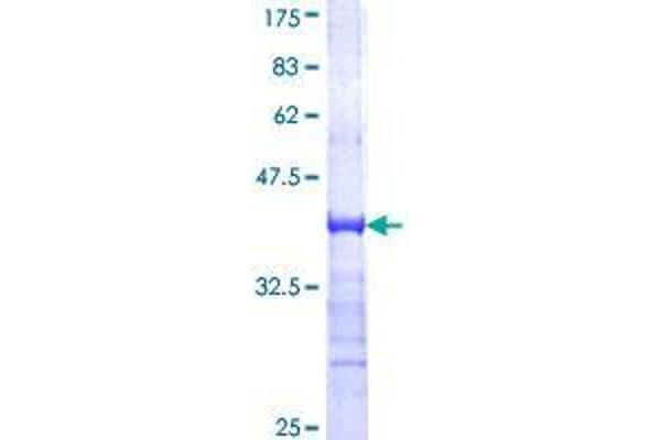 TRIM33 Protein (AA 1006-1105) (GST tag)