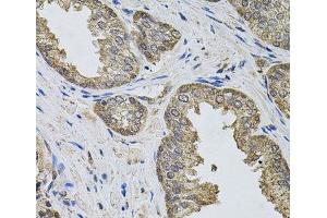 Immunohistochemistry of paraffin-embedded Human prostate using IGSF3 Polyclonal Antibody (IGSF3 抗体)