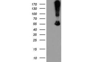Western Blotting (WB) image for anti-rho GTPase Activating Protein 2 (ARHGAP2) antibody (ABIN1499627)