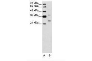 Image no. 2 for anti-Defective in Cullin Neddylation 1, Domain Containing 1 (DCUN1D1) (AA 31-80) antibody (ABIN6736642) (DCUN1D1 抗体  (AA 31-80))