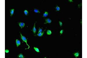 Immunofluorescent analysis of U251 cells using ABIN7149892 at dilution of 1:100 and Alexa Fluor 488-congugated AffiniPure Goat Anti-Rabbit IgG(H+L) (DEF6 抗体  (AA 20-114))