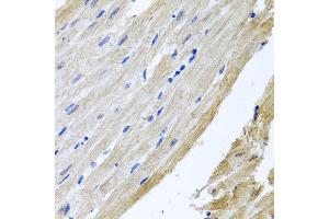 Immunohistochemistry of paraffin-embedded rat heart using PRPH antibody at dilution of 1:100 (x40 lens). (Peripherin 抗体)