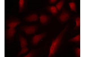 Immunofluorescence staining of methanol-fixed Hela cells using GATA1(Phospho-Ser310) Antibody. (GATA1 抗体  (pSer310))