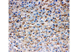 Immunohistochemistry (IHC) image for anti-Hydroxysteroid (17-Beta) Dehydrogenase 1 (HSD17B1) (AA 29-43), (N-Term) antibody (ABIN5518679)
