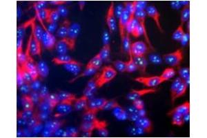 Immunofluorescence (IF) image for anti-Fibrillarin (FBL) antibody (ABIN371824) (Fibrillarin 抗体)