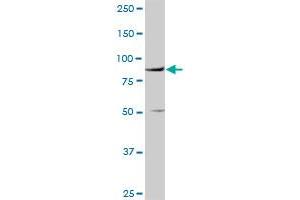 Western Blotting (WB) image for anti-Vascular Cell Adhesion Molecule 1 (VCAM1) (AA 1-739) antibody (ABIN521306)