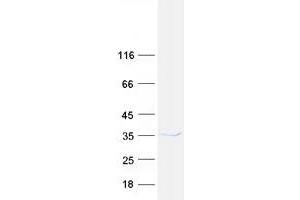 Western Blotting (WB) image for CUE Domain Containing 2 (CUEDC2) protein (Myc-DYKDDDDK Tag) (ABIN2712624)