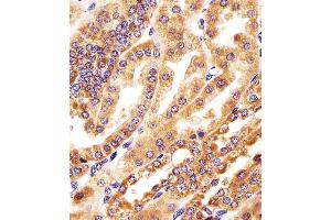 (ABIN6244258 and ABIN6578390) staining GMCL1 in human kidney tissue sections by Immunohistochemistry (IHC-P - paraformaldehyde-fixed, paraffin-embedded sections). (GMCL1 抗体  (AA 281-315))