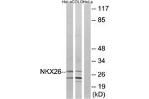 Western blot analysis of extracts from HeLa/COLO cells, using NKX26 Antibody. (NKX2-6 抗体  (AA 91-140))
