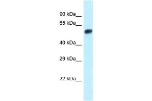 WB Suggested Anti-Eepd1 Antibody Titration: 1. (EEPD1 抗体  (N-Term))