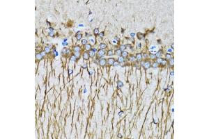 Immunohistochemistry of paraffin-embedded mouse brain using MAP1LC3A antibody. (MAP1LC3A 抗体)