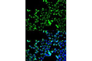 Immunofluorescence analysis of A549 cells using CALR antibody. (Calreticulin 抗体)