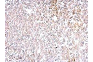 IHC-P Image Chromogranin C antibody detects SCG2 protein at cytosol on rat RT2 xenograft by immunohistochemical analysis. (SCG2 抗体)