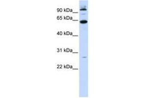 Image no. 1 for anti-MNT, MAX Dimerization Protein (MNT) (N-Term) antibody (ABIN6740600)