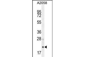 S1 Antibody (N-term) (ABIN654456 and ABIN2844190) western blot analysis in  cell line lysates (35 μg/lane). (AP3S1 抗体  (N-Term))