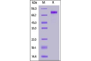 Human LIV-1, Fc Tag on  under reducing (R) condition. (SLC39A6 Protein (AA 29-325) (Fc Tag))