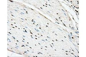 Immunohistochemical staining of paraffin-embedded liver tissue using anti-BSG mouse monoclonal antibody. (CD147 抗体)